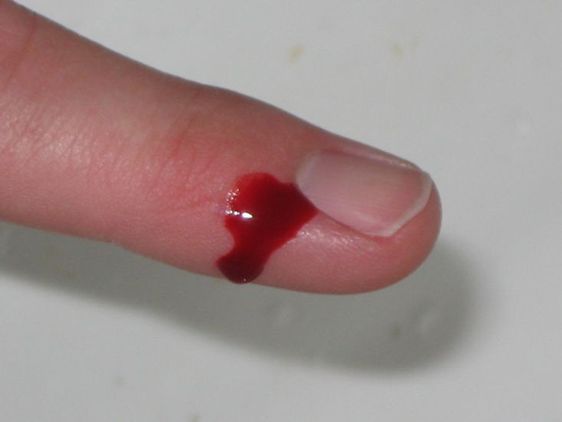 Jak nakleić plaster na palec