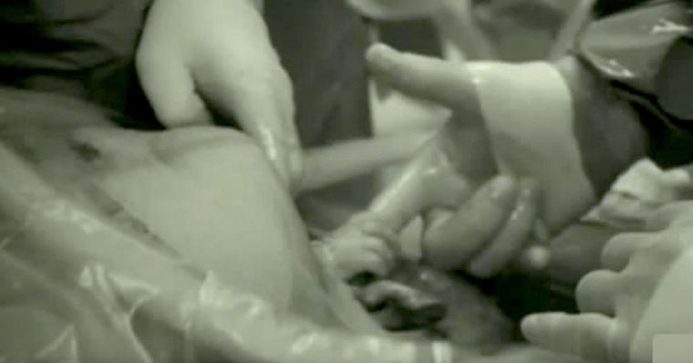 nienarodzone dziecko chwyta za palec lekarza