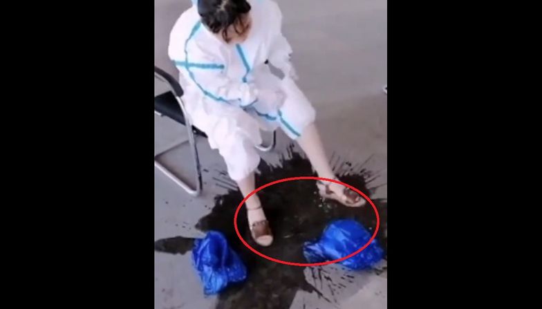 Koronawirus. Doktor zdjęła kombinezon. Straszny widok