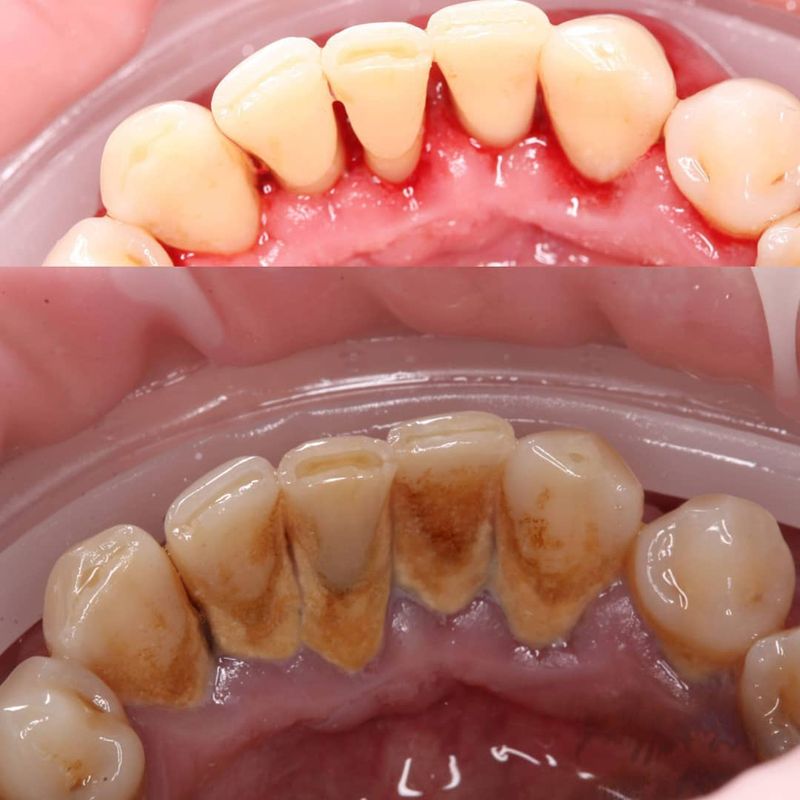 instagram.com/hygienic_dental