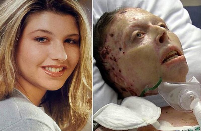 Przed i po: Judy Malinowski (33 l.) na zdjęciu po lewej zanim została podpalona. Po prawej stronie widzimy Judy po brutalnym czynie jej byłego chłopaka. Zdjęcie zostało zrobiono 16 miesięcy od momentu podpalenia w szpitalnym łóżku w Ohio.