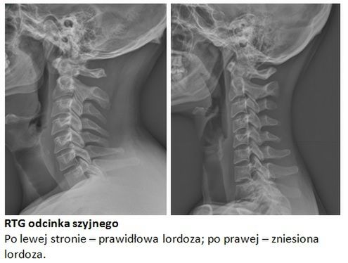 Neurochirurgwroclaw.com.pl