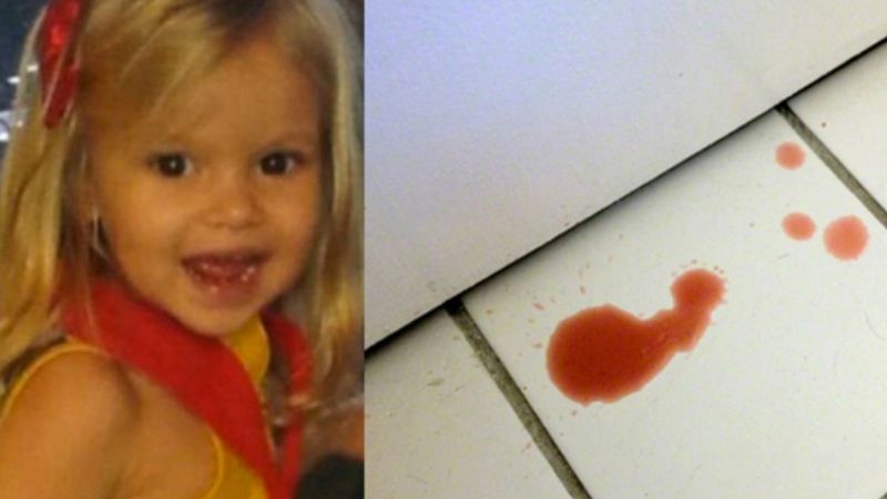 Dziewczynka zaczęła sinieć i wymiotować krwią. Badanie rentgenowskie ujawniło szokującą prawdę