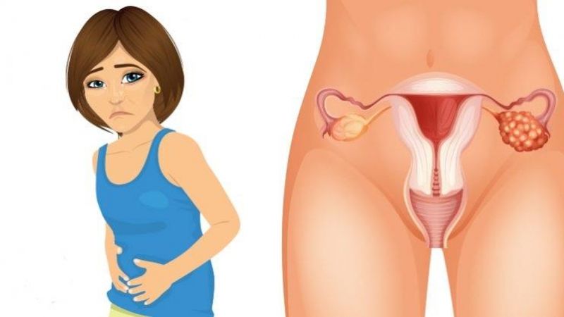 4 wczesne objawy raka jajnika, które każda kobieta powinna znać