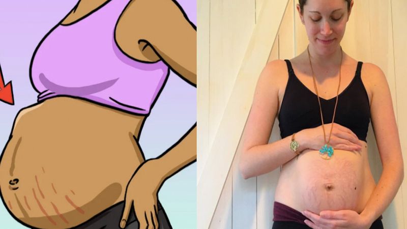 27 mocno obrzydliwych rzeczy, towarzyszących kobietom w ciąży. Wszystkie matki znają ten ból