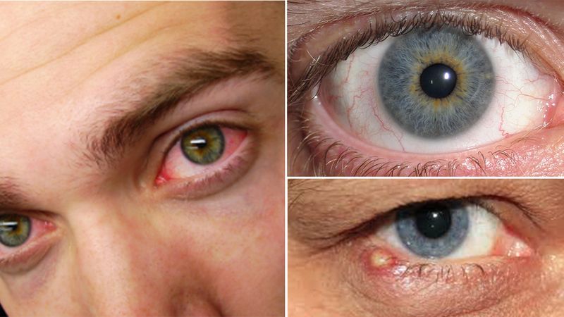 12 popularnych chorób, które rozpoznasz po oczach. Nie ignoruj tych znaków!
