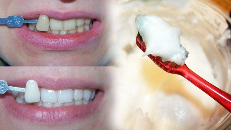 Płukanie ust olejem kokosowym to naturalny detoks. Zabija bakterie i wybiela zęby