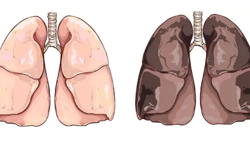 4 regenerujące witaminy, które oczyszczą płuca palacza z toksyn