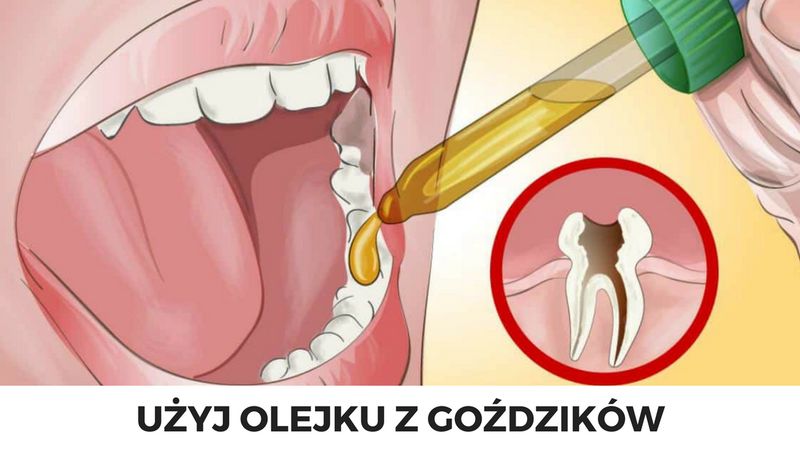 Naturalne sposoby na ból zęba. Pokonasz go w 10 minut!