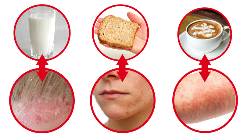 6 produktów, które rujnują Twoją skórę. Bez tej wiedzy nie pozbędziesz się trądziku