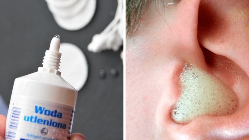 10 domowych metod, które pomogą zwalczyć infekcję ucha. Są skuteczne i kosztują grosze