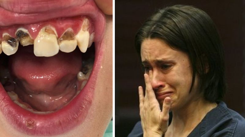 Zdrowe zęby mają tylko bogaci. Fatalne statystyki dołują Polaków