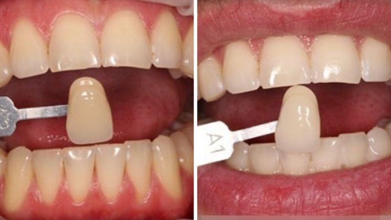 7 wskazówek dentystów o pielęgnacji zębów, których lekceważenie przyniesie przykre konsekwencje