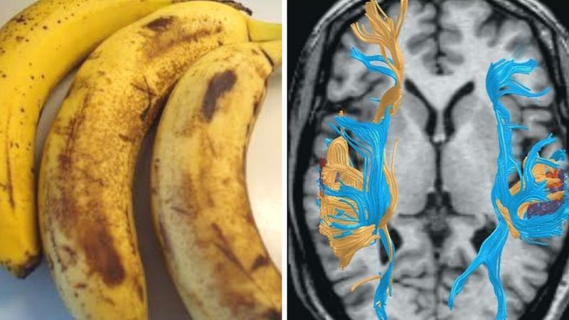 Jedzenie bananów ma ogromny wpływ na zdrowie psychiczne. Są naturalnym lekiem