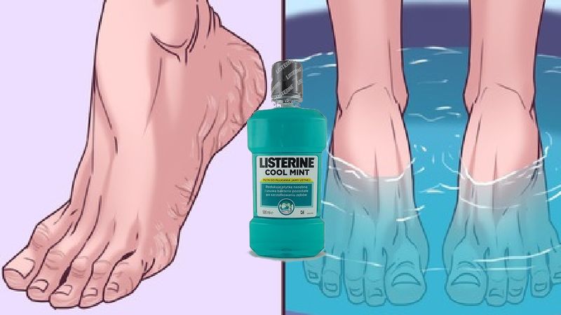 Listerine nie tylko do jamy ustnej. Płyn może mieć zbawienne działanie dla Twoich stóp