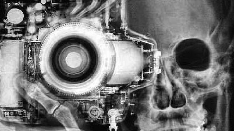 12 zdjęć rentgenowskich, które pokazują to, co niewidoczne gołym okiem. Robią wrażenie!