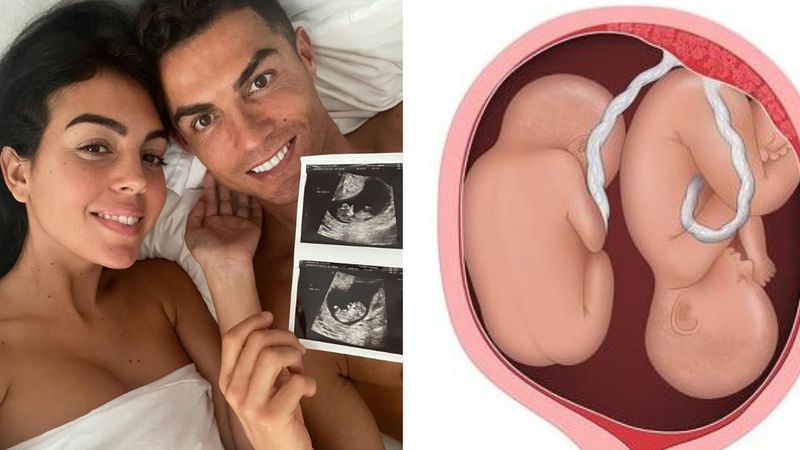 Syn Cristiano Ronaldo zmarł od razu po porodzie. Niebezpieczeństwa związane z bliźniaczą ciążą