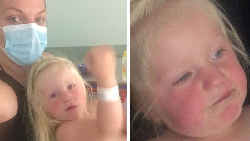 2-latka trafiła do szpitala z powodu przegrzania. Fala upałów zbiera żniwa