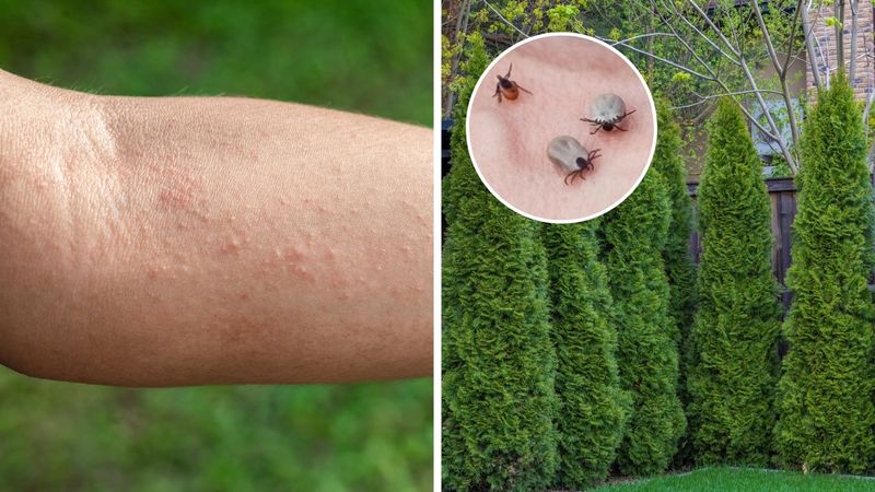 czy tuje są szkodliwe - ręka z wysypką i drzewa tuj w ogrodzie