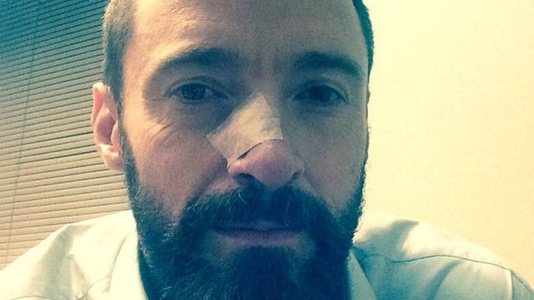Hugh Jackman