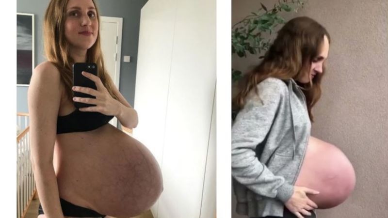 Czy wróciła do formy sprzed porodu? O jej ogromnym ciążowym brzuszku huczało w sieci!