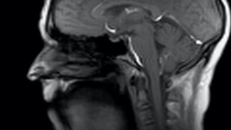 Aparat MRI sprawia, że możemy zobaczyć, jak wygląda ludzkie ciało od wewnątrz