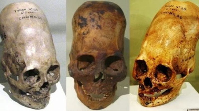 W końcu odkryto, co skrywa się za sekretem wydłużonych czaszek znalezionych w Peru