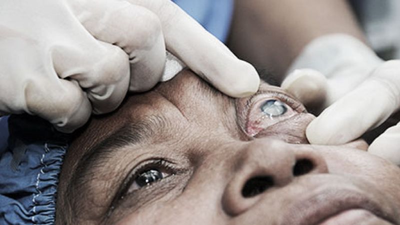 Próba przywrócenia wzroku u dwóch pacjentów z chorobą zwyrodnieniową zakończyła się sukcesem
