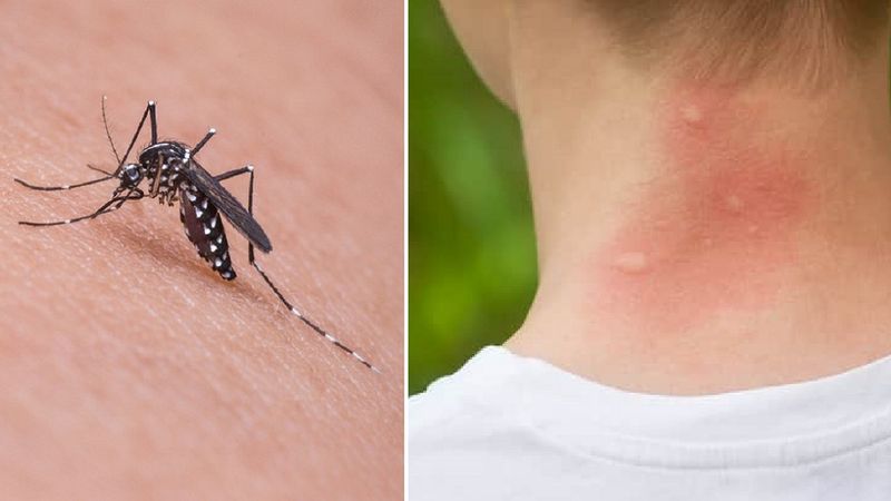 Komary gryzą cię znacznie częściej niż innych? Biolodzy wyjaśniają, dlaczego tak się dzieje
