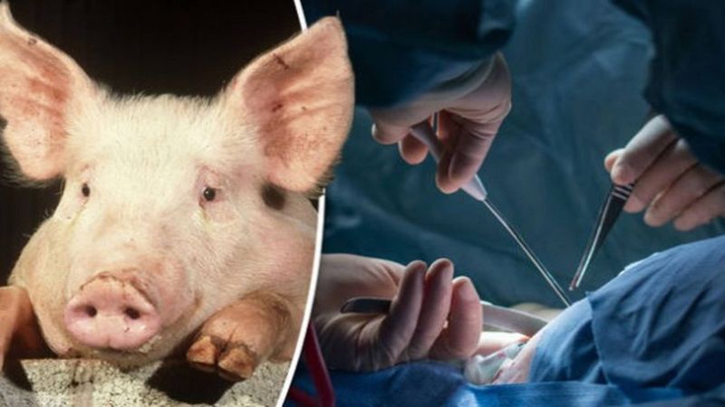 Czy przeszczepienie człowiekowi narządów od świni jest bezpieczne? Naukowcy wreszcie mają odpowiedź