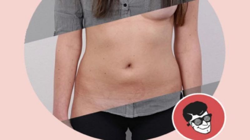 Aplikacja DeepNude do „rozbierania” zdjęć kobiet znika z sieci. Popularność przerosła twórców
