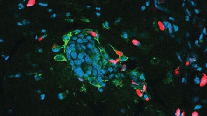 Komórki rakowe zamieniają się w kanibali, by przetrwać chemioterapię