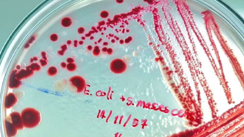 Sztuczna inteligencja wykryła superantybiotyk, który może pomóc walczyć z antybiotykoopornością