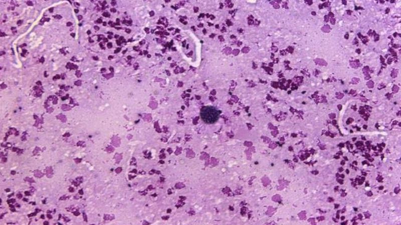 Toxoplasma gondii, czyli maleńki pasożyt, który może zainfekować mózg i zmienić twoje zachowanie