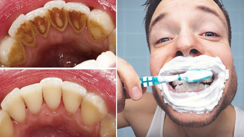 Dentyści ustalili, czy należy myć zęby przed śniadaniem, czy też po pierwszym posiłku