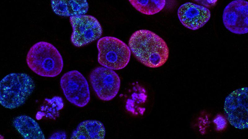 W nowym badaniu odkryto, że komórki rakowe hibernują się, by przetrwać chemioterapię