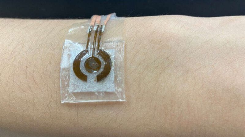 Zespół naukowców opracował nieinwazyjne urządzenie do monitorowania glukozy bez użycia igieł