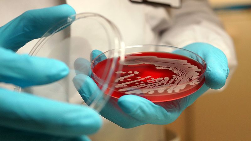 Główną przyczyną zgonów na całym świecie są superbakterie oporne na antybiotyki