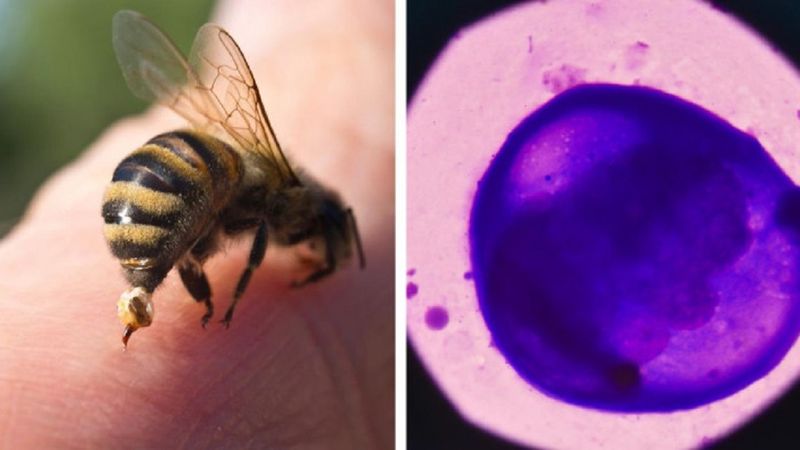 Jad pszczeli okazuje się niezwykle skuteczny w zabijaniu agresywnych komórek raka piersi
