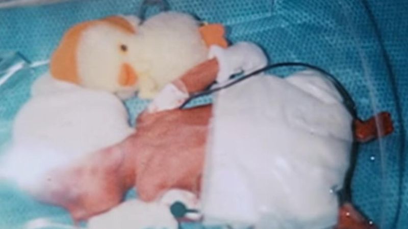 Kiedy ten chłopiec się urodził, lekarze nie byli w stanie powiedzieć, co stanie się z nim za 2 lata