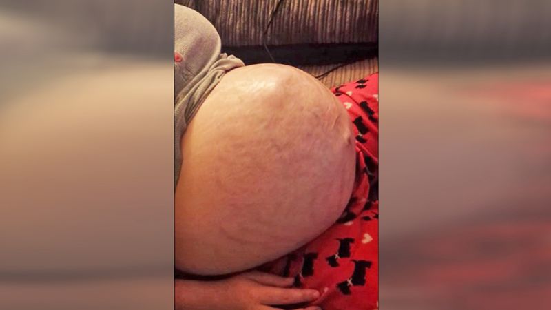 Filmował ciążowy brzuszek swojej żony, kiedy maluch zaczął robić coś nieoczekiwanego!