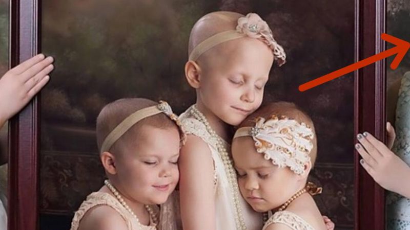 Zdjęcie 3 dziewczynek obiegło cały świat z powodu ich choroby. To, co stało się im 2 lata później jest piękne