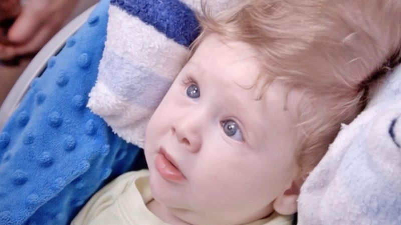 Innowacyjna operacja mózgu uratowała życie małemu dziecku, któremu nikt nie dawał szans na przeżycie…