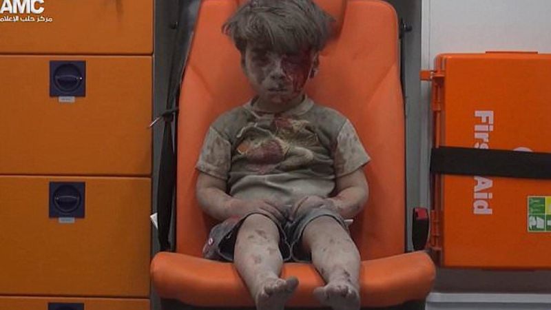 To zdjęcie stało się symbolem syryjskiej wojny. Wizerunek poszkodowanego chłopca obiegł cały świat!
