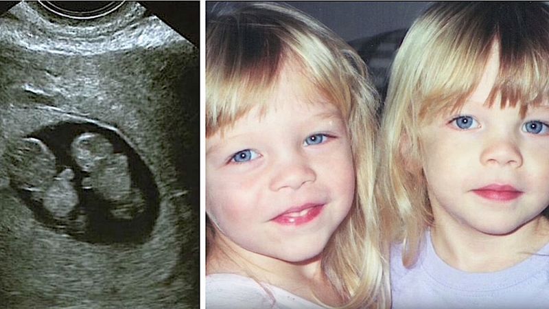 Po 12 latach u jednej z bliźniaczek ujawnia się rzadka choroba. Siostry nie poddają się i walczą do końca