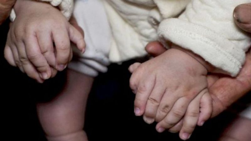 Ten 3-miesięczny chłopiec cierpi na chorobę, która zdarza się raz na 1000 urodzeń. Ma aż 31 palców!