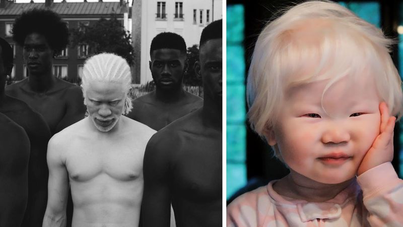 15 osób z albinizmem, które hipnotyzują swoim nieziemskim pięknem. Są jedyni w swoim rodzaju!