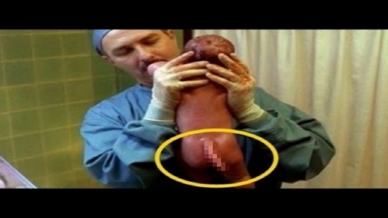 Kobieta rodzi dziecko, gdy na sali porodowej okazuje się, że ma ono ogon. Lekarze są tym przerażeni