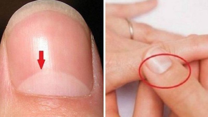 Mało kto wie, co oznaczają te białe półkola na paznokciach. Ich wygląd może świadczyć o czymś ważnym