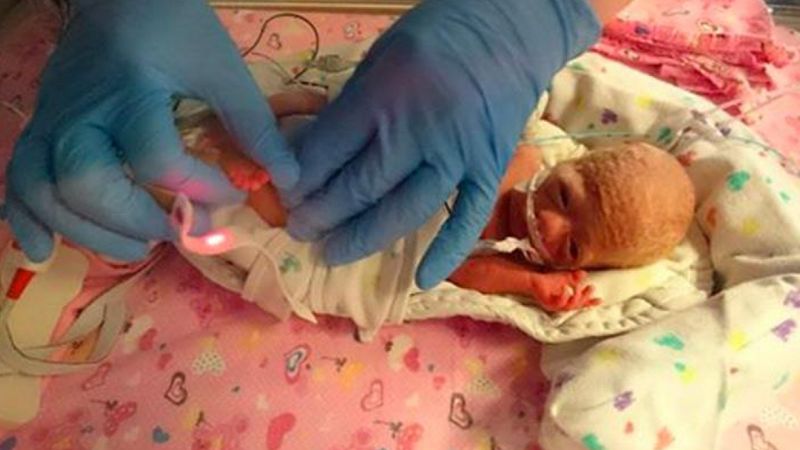 Urodziła się tak mała, że w każdej sekundzie mogła umrzeć. Lekarze podjęli szokującą decyzję, by ją ratować